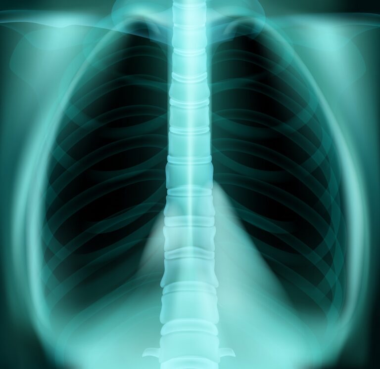 metastaze resitev